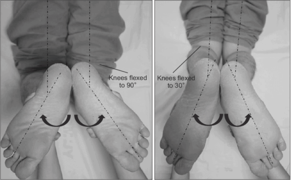 The Complete Guide To An Mcl Tear Kinetic Labs Toronto