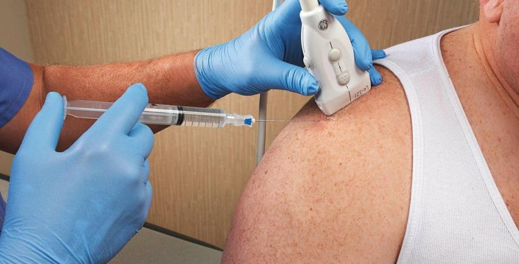 injecting steroids into shoulder