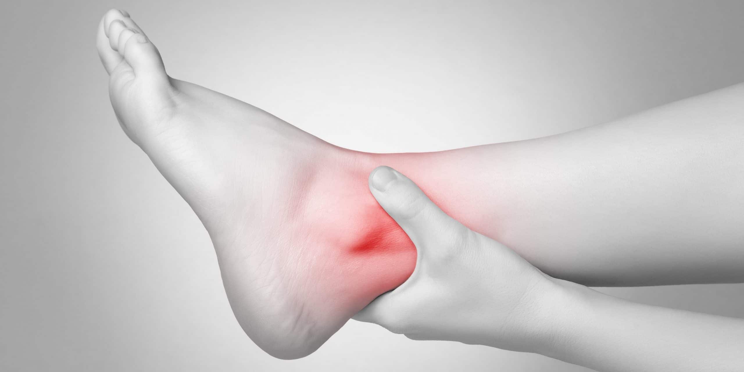 Complete Lateral Ankle Sprain Guide