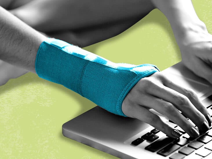 brace for carpal tunnel syndrome