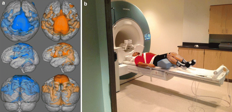 fMRI for ACL tear brain changes