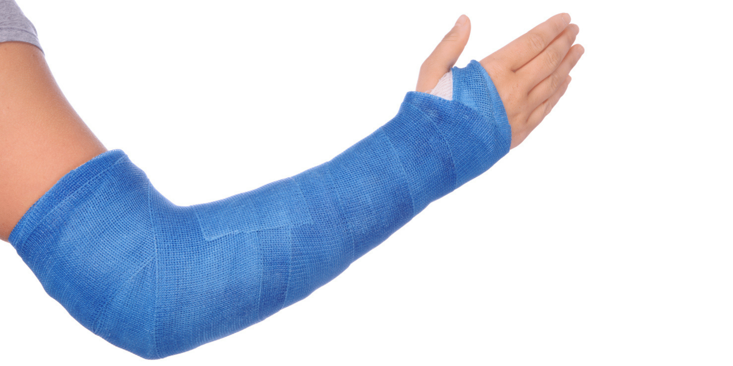 elbow fracture physiotherapy toronto