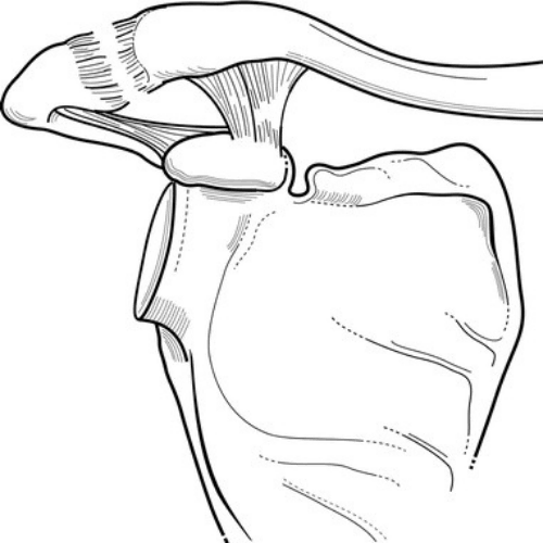 ac joint injury