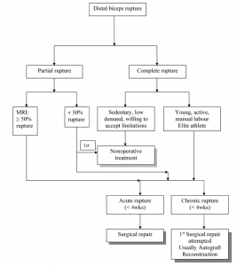 The Complete Guide to Distal Biceps Rupture - Kinetic Labs | Toronto ...