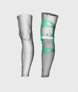 knee-brace-type-1