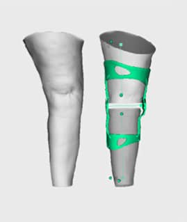 knee-brace-type-2